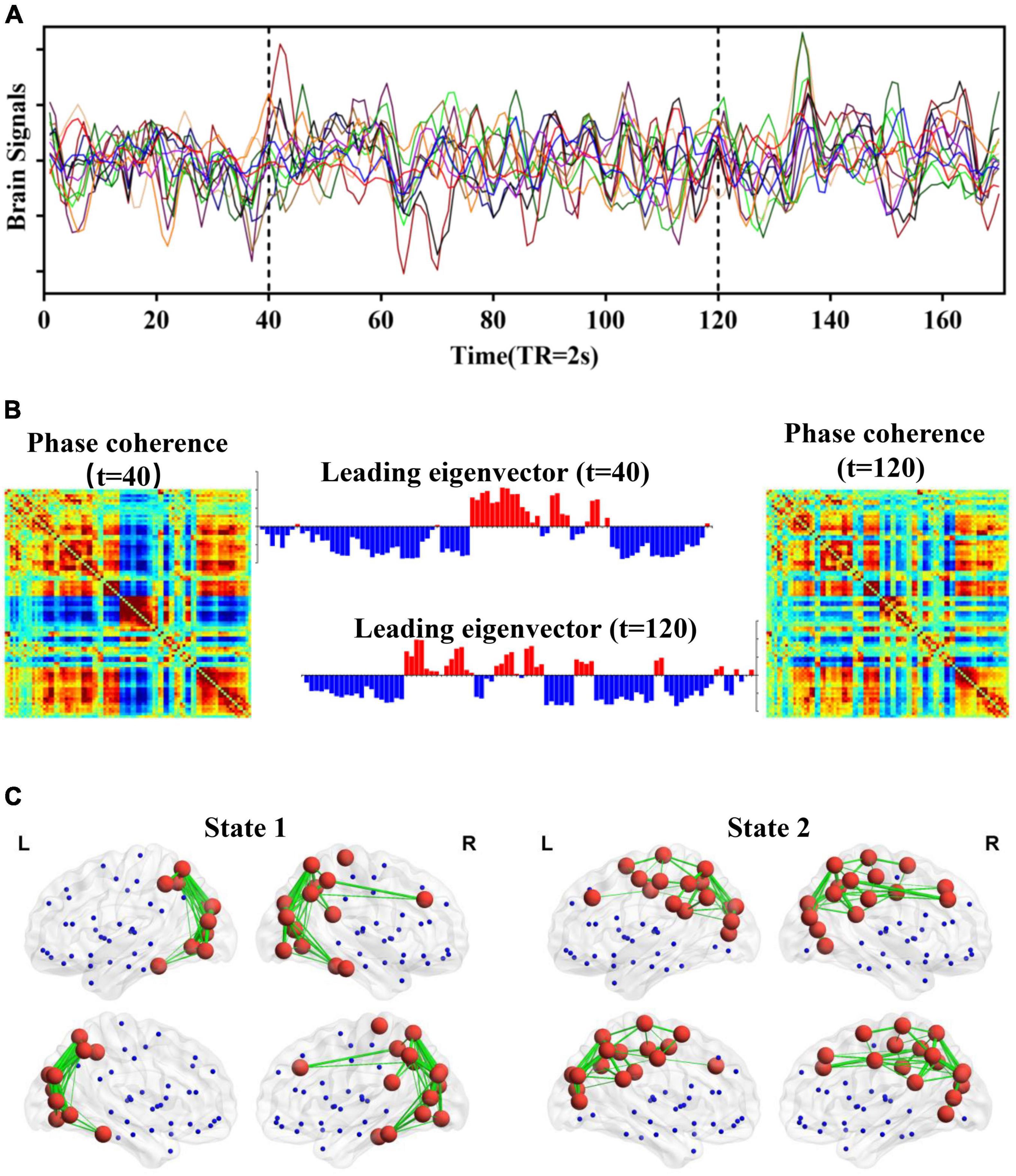 Alteration of resting-state network dynamics in autism spectrum disorder based on leading eigenvector dynamics analysis